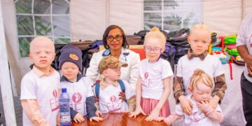 RDC – La Fondation Esther Fayulu apporte son appui aux enfants albinos pour la rentrée scolaire 2025